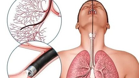 معرفی کلی کلینیک تست ریه (برونکوسکوپی)